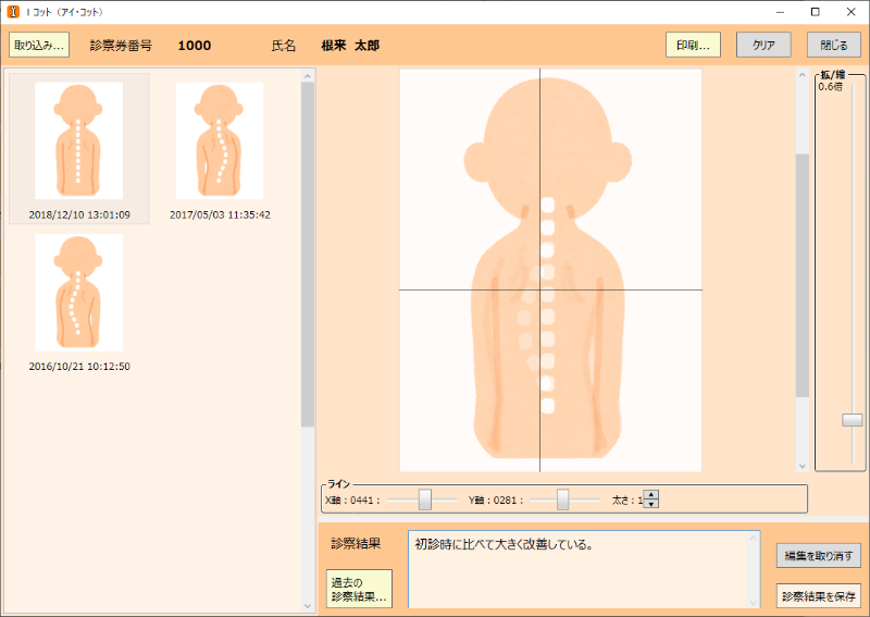 複数画像を重ね合わせ、X軸Y軸を確認している画面