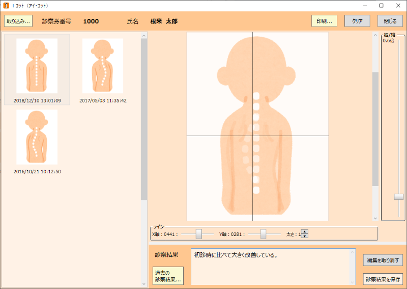 複数画像を重ね合わせ、Ｘ軸Ｙ軸を確認している画面